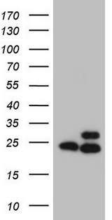 RPL10 / Ribosomal Protein L10 Antibody - HEK293T cells were transfected with the pCMV6-ENTRY control. (Left lane) or pCMV6-ENTRY RPL10. (Right lane) cDNA for 48 hrs and lysed. Equivalent amounts of cell lysates. (5 ug per lane) were separated by SDS-PAGE and immunoblotted with anti-RPL10. (1:500)