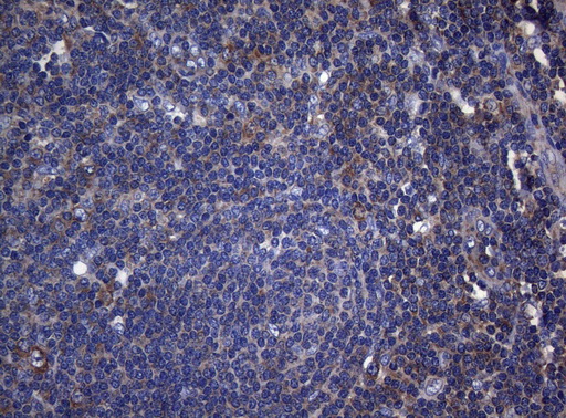 RPL10 / Ribosomal Protein L10 Antibody - Immunohistochemical staining of paraffin-embedded Human tonsil within the normal limits using anti-RPL10 mouse monoclonal antibody. (Heat-induced epitope retrieval by 1mM EDTA in 10mM Tris buffer. (pH8.5) at 120°C for 3 min. (1:150)