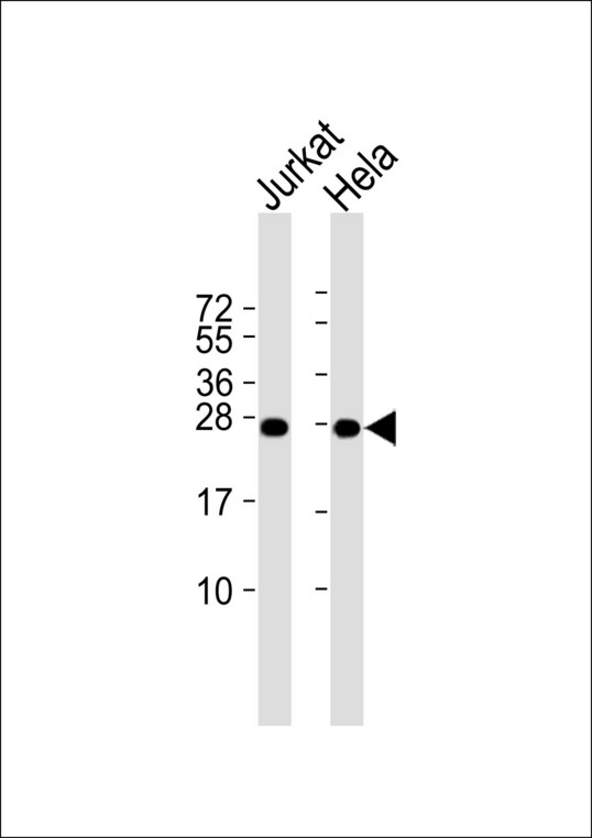 RPL10 / Ribosomal Protein L10 Antibody - All lanes : Anti-RPL10 Antibody at 1:1000 dilution Lane 1: Jurkat whole cell lysates Lane 2: HeLa whole cell lysates Lysates/proteins at 20 ug per lane. Secondary Goat Anti-Rabbit IgG, (H+L),Peroxidase conjugated at 1/10000 dilution Predicted band size : 25 kDa Blocking/Dilution buffer: 5% NFDM/TBST.