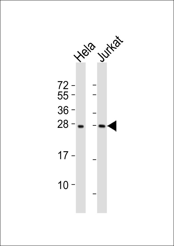 RPL10 / Ribosomal Protein L10 Antibody - All lanes : Anti-RPL10 Antibody at 1:1000 dilution Lane 1: HeLa whole cell lysates Lane 2: Jurkat whole cell lysates Lysates/proteins at 20 ug per lane. Secondary Goat Anti-Rabbit IgG, (H+L),Peroxidase conjugated at 1/10000 dilution Predicted band size : 25 kDa Blocking/Dilution buffer: 5% NFDM/TBST.