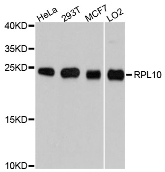 RPL10 / Ribosomal Protein L10 Antibody - Western blot analysis of extracts of various cell lines.