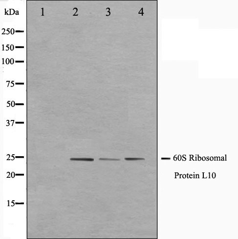 RPL10 / Ribosomal Protein L10 Antibody - Western blot analysis on K562, Jurkat and 293 cell lysates using RPL10 antibody. The lane on the left is treated with the antigen-specific peptide.