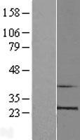RPL10 / Ribosomal Protein L10 Protein - Western validation with an anti-DDK antibody * L: Control HEK293 lysate R: Over-expression lysate