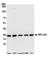RPL10A Antibody - Detection of human and mouse RPL10A by western blot. Samples: Whole cell lysate (50 µg) from HeLa, HEK293T, Jurkat, mouse TCMK-1, and mouse NIH 3T3 cells prepared using NETN lysis buffer. Antibody: Affinity purified rabbit anti-RPL10A antibody used for WB at 0.1 µg/ml. Detection: Chemiluminescence with an exposure time of 10 seconds.