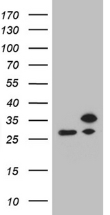 RPL10A Antibody - HEK293T cells were transfected with the pCMV6-ENTRY control. (Left lane) or pCMV6-ENTRY RPL10A. (Right lane) cDNA for 48 hrs and lysed. Equivalent amounts of cell lysates. (5 ug per lane) were separated by SDS-PAGE and immunoblotted with anti-RPL10A. (1:500)