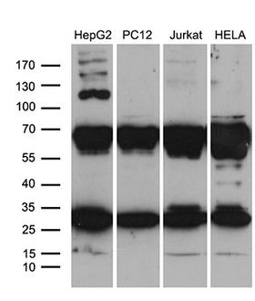 RPL10A Antibody - Western blot analysis of extracts. (35ug) from 4 different cell lines by using anti-RPL10A monoclonal antibody. (1:500)