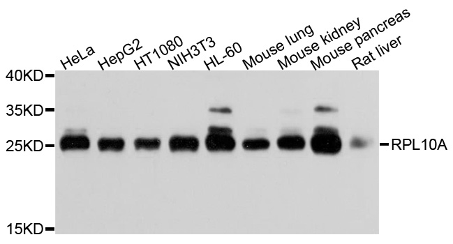 RPL10A Antibody - Western blot analysis of extracts of various cells.