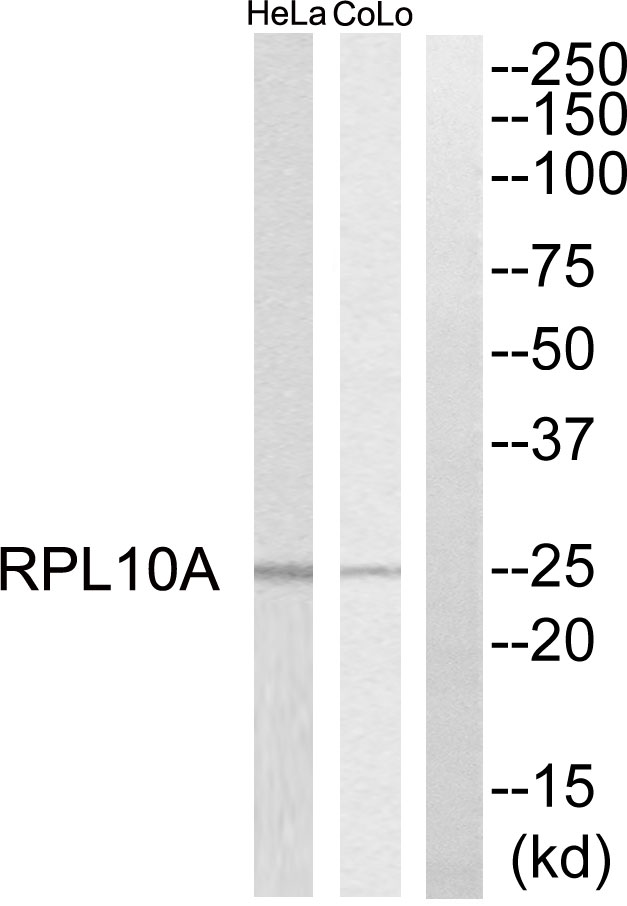 RPL10A Antibody - Western blot of extracts from HeLa cells and COLO205 cells, using RPL10A antibody.