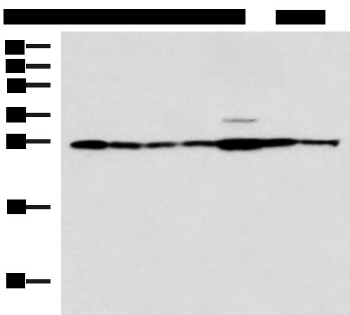 RPL10A Antibody - Western blot analysis of Rat liver tissue Mouse kidney tissue Mouse lung tissue HUVEC Jurkat Hela HepG2 cell lysates  using RPL10A Polyclonal Antibody at dilution of 1:700