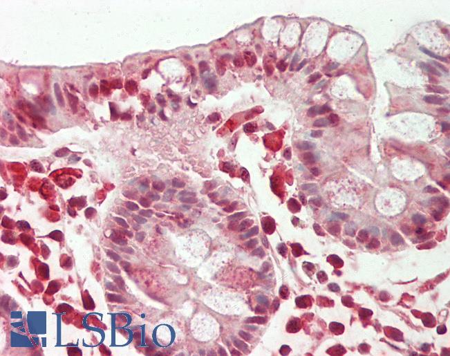 RPL10A Antibody - Human Colon: Formalin-Fixed, Paraffin-Embedded (FFPE).  This image was taken for the unconjugated form of this product. Other forms have not been tested.