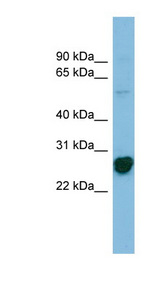 RPL10A Antibody - RPL10A antibody western blot of Jurkat lysate.  This image was taken for the unconjugated form of this product. Other forms have not been tested.