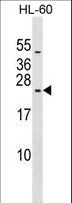 RPL10L Antibody - RPL10L Antibody western blot of HL-60 cell line lysates (35 ug/lane). The RPL10L antibody detected the RPL10L protein (arrow).