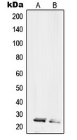 RPL10L Antibody - Western blot analysis of RPL10L expression in HL60 (A); HeLa (B) whole cell lysates.
