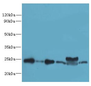 RPL10L Antibody - Western blot. All lanes: RPL10L antibody at 4 ug/ml. Lane 1: Jurkat whole cell lysate. Lane 2: HeLa whole cell lysate. Lane 3: HL60 whole cell lysate. Lane 4: K562 whole cell lysate. Lane 5: Mouse liver tissue. Lane 6: MCF7 whole cell lysate. Secondary antibody: Goat polyclonal to Rabbit IgG at 1:10000 dilution. Predicted band size: 25 kDa. Observed band size: 25 kDa.