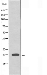 RPL10L Antibody - Western blot analysis of extracts of HeLa cells using RPL10L antibody.