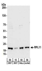 RPL11 / Ribosomal Protein L11 Antibody - Detection of Human RPL11 by Western Blot. Samples: Whole cell lysate from 293T (15 and 50 ug), HeLa (50 ug), and Jurkat (50 ug) cells. Antibodies: Affinity purified rabbit anti-RPL11 antibody used for WB at 0.4 ug/ml. Detection: Chemiluminescence with an exposure time of 30 seconds.