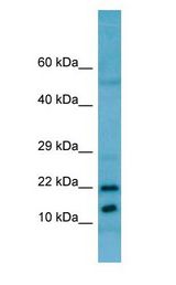 RPL11 / Ribosomal Protein L11 Antibody - RPL11 / L11 antibody Western Blot of HeLa.  This image was taken for the unconjugated form of this product. Other forms have not been tested.