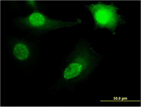 RPL11 / Ribosomal Protein L11 Antibody - Immunofluorescence of monoclonal antibody to RPL11 on HeLa cell . [antibody concentration 10 ug/ml]