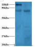RPL11 / Ribosomal Protein L11 Antibody - Western blot of 60S ribosomal protein L11 antibody at 2 ug/ml. Lane 1:293T whole cell lysate. Lane 2: EC109 whole cell lysate. Secondary: Goat polyclonal to Rabbit IgG at 1:15000 dilution. Predicted band size: 20 kDa. Observed band size: 118 kDa Additional bands at: 25,30,40ï¼Œ80 kDa. We are unsure as to the identity of these extra bands. This image was taken for the unconjugated form of this product. Other forms have not been tested.
