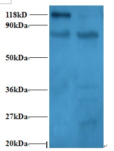 RPL11 / Ribosomal Protein L11 Antibody - Western blot of 60S ribosomal protein L11 antibody at 2 ug/ml. Lane 1:293T whole cell lysate. Lane 2: EC109 whole cell lysate. Secondary: Goat polyclonal to Rabbit IgG at 1:15000 dilution. Predicted band size: 20 kDa. Observed band size: 118 kDa Additional bands at: 25,30,40ï¼Œ80 kDa. We are unsure as to the identity of these extra bands. This image was taken for the unconjugated form of this product. Other forms have not been tested.