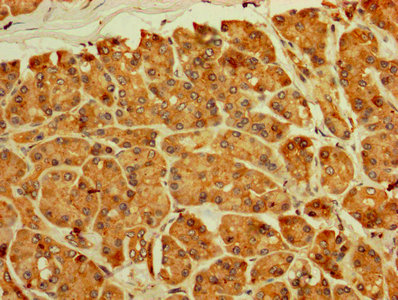 RPL11 / Ribosomal Protein L11 Antibody - IHC image of RPL11 Antibody diluted at 1:250 and staining in paraffin-embedded human pancreatic tissue performed on a Leica BondTM system. After dewaxing and hydration, antigen retrieval was mediated by high pressure in a citrate buffer (pH 6.0). Section was blocked with 10% normal goat serum 30min at RT. Then primary antibody (1% BSA) was incubated at 4°C overnight. The primary is detected by a biotinylated secondary antibody and visualized using an HRP conjugated SP system.