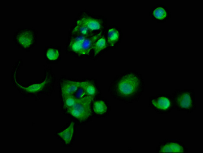 RPL11 / Ribosomal Protein L11 Antibody - Immunofluorescence staining of MCF-7 cells with RPL11 Antibody at 1:83, counter-stained with DAPI. The cells were fixed in 4% formaldehyde, permeabilized using 0.2% Triton X-100 and blocked in 10% normal Goat Serum. The cells were then incubated with the antibody overnight at 4°C. The secondary antibody was Alexa Fluor 488-congugated AffiniPure Goat Anti-Rabbit IgG(H+L).