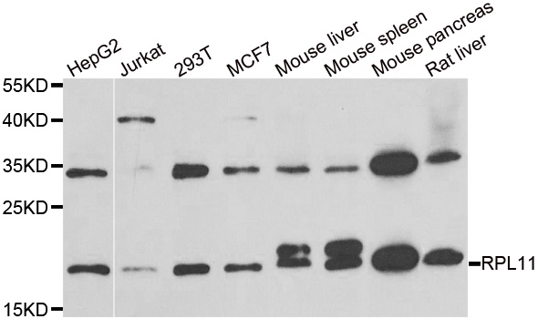 RPL11 / Ribosomal Protein L11 Antibody - Western blot analysis of extracts of various cell lines.