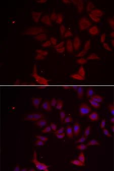RPL11 / Ribosomal Protein L11 Antibody - Immunofluorescence analysis of MCF-7 cells.
