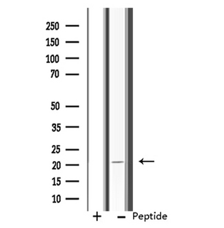 RPL11 / Ribosomal Protein L11 Antibody - Western blot analysis of extracts of K562 cells using RPL11 antibody.