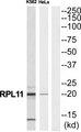 RPL11 / Ribosomal Protein L11 Antibody - Western blot analysis of extracts from K562 cells and Hela cells, using RPL11 antibody.