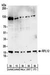 RPL12 / Ribosomal Protein L12 Antibody - Detection of Human and Mouse RPL12 by Western Blot. Samples: Whole cell lysate from Jurkat (15 and 50 ug), HeLa (50 ug), 293T (50 ug), and mouse NIH3T3 , (50 ug) cells. Antibodies: Affinity purified rabbit anti-RPL12 antibody used for WB at 0.4 ug/ml. Detection: Chemiluminescence with an exposure time of 3 minutes.