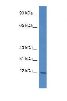RPL12 / Ribosomal Protein L12 Antibody - RPL12 antibody Western blot of Fetal Brain lysate. Antibody concentration 1 ug/ml.  This image was taken for the unconjugated form of this product. Other forms have not been tested.