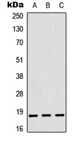 RPL12 / Ribosomal Protein L12 Antibody - Western blot analysis of RPL12 expression in HeLa (A); SHSY5Y (B); Rat muscle (C) whole cell lysates.