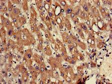 RPL12 / Ribosomal Protein L12 Antibody - Immunohistochemistry of paraffin-embedded human liver tissue using RPL12 Antibody at dilution of 1:100