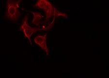 RPL12 / Ribosomal Protein L12 Antibody - Staining HepG2 cells by IF/ICC. The samples were fixed with PFA and permeabilized in 0.1% Triton X-100, then blocked in 10% serum for 45 min at 25°C. The primary antibody was diluted at 1:200 and incubated with the sample for 1 hour at 37°C. An Alexa Fluor 594 conjugated goat anti-rabbit IgG (H+L) antibody, diluted at 1/600, was used as secondary antibody.