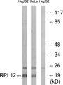 RPL12 / Ribosomal Protein L12 Antibody - Western blot analysis of extracts from HepG2 cells and HeLa cells, using RPL12 antibody.