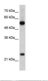 RPL13 / Ribosomal Protein L13 Antibody - HepG2 Cell Lysate.  This image was taken for the unconjugated form of this product. Other forms have not been tested.