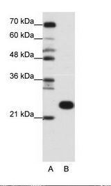 RPL13 / Ribosomal Protein L13 Antibody - B: Jurkat Cell Lysate.  This image was taken for the unconjugated form of this product. Other forms have not been tested.