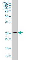 RPL13 / Ribosomal Protein L13 Antibody - RPL13 monoclonal antibody (M01), clone 3F6 Western Blot analysis of RPL13 expression in HeLa.