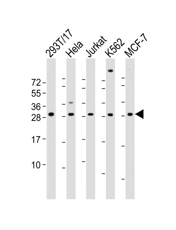 RPL13 / Ribosomal Protein L13 Antibody - All lanes: Anti-RPL13 Antibody (Center) at 1:2000 dilution Lane 1: 293T/17 whole cell lysate Lane 2: Hela whole cell lysate Lane 3: Jurkat whole cell lysate Lane 4: K562 whole cell lysate Lane 5: MCF-7 whole cell lysate Lysates/proteins at 20 µg per lane. Secondary Goat Anti-Rabbit IgG, (H+L), Peroxidase conjugated at 1/10000 dilution. Predicted band size: 24 kDa Blocking/Dilution buffer: 5% NFDM/TBST.