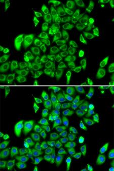 RPL13 / Ribosomal Protein L13 Antibody - Immunofluorescence analysis of MCF7 cells.