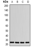 RPL13 / Ribosomal Protein L13 Antibody - Western blot analysis of RPL13 expression in HT29 (A); HeLa (B); mouse spleen (C); rat lung (D) whole cell lysates.