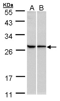 RPL13A Antibody - Sample (30 ug of whole cell lysate). A:293T, B: HeLa. 10% SDS PAGE. RPL13A antibody diluted at 1:500
