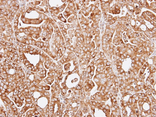RPL13A Antibody - IHC of paraffin-embedded NCI-N87 xenograft using RPL13A antibody at 1:100 dilution.