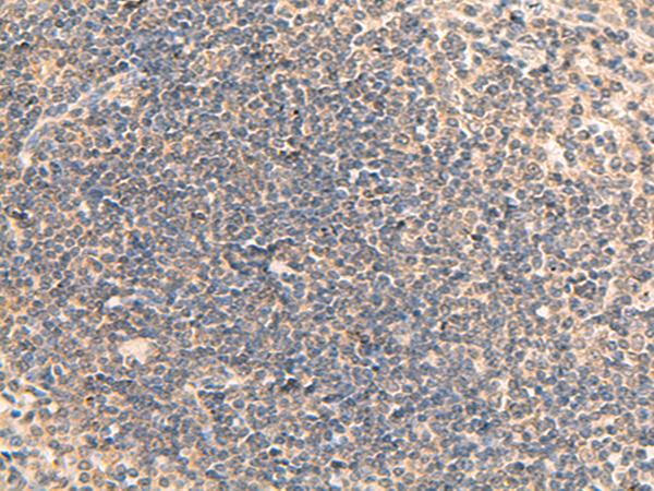 RPL13A Antibody - Immunohistochemistry of paraffin-embedded Human tonsil tissue  using RPL13A Polyclonal Antibody at dilution of 1:95(×200)