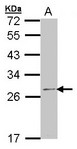RPL14 / Ribosomal Protein L14 Antibody - Sample (30 ug of whole cell lysate). A:293T. 12% SDS PAGE. RPL14 antibody diluted at 1:1000.