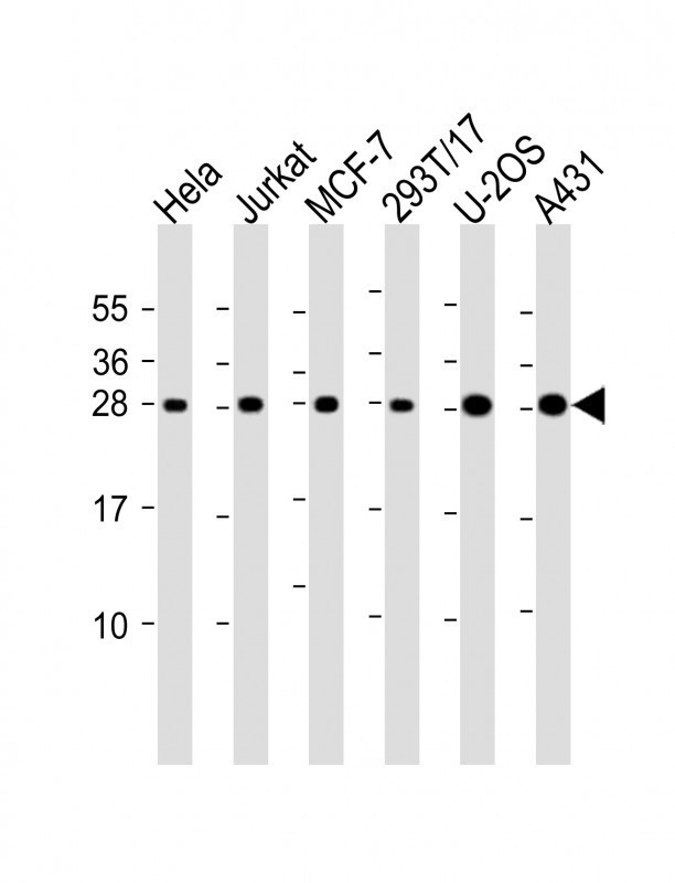 RPL14 / Ribosomal Protein L14 Antibody - All lanes: Anti-RPL14 Antibody (Center) at 1:2000 dilution. Lane 1: HeLa whole cell lysate. Lane 2: Jurkat whole cell lysate. Lane 3: MCF-7 whole cell lysate. Lane 4: 293T/17 whole cell lysate. Lane 5: U-2OS whole cell lysate. Lane 6: A431 whole cell lysate Lysates/proteins at 20 ug per lane. Secondary Goat Anti-Rabbit IgG, (H+L), Peroxidase conjugated at 1:10000 dilution. Predicted band size: 23 kDa. Blocking/Dilution buffer: 5% NFDM/TBST.