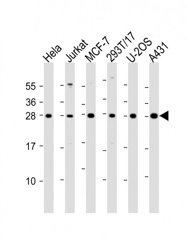 RPL14 / Ribosomal Protein L14 Antibody - All lanes: Anti-RPL14 Antibody (Center) at 1:2000 dilution. Lane 1: HeLa whole cell lysate. Lane 2: Jurkat whole cell lysate. Lane 3: MCF-7 whole cell lysate. Lane 4: 293T/17 whole cell lysate. Lane 5: U-2OS whole cell lysate. Lane 6: A431 whole cell lysate Lysates/proteins at 20 ug per lane. Secondary Goat Anti-Rabbit IgG, (H+L), Peroxidase conjugated at 1:10000 dilution. Predicted band size: 23 kDa. Blocking/Dilution buffer: 5% NFDM/TBST.