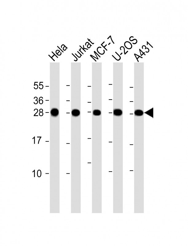 RPL14 / Ribosomal Protein L14 Antibody - All lanes: Anti-RPL14 Antibody (C-Term) at 1:2000 dilution. Lane 1: HeLa whole cell lysate. Lane 2: Jurkat whole cell lysate. Lane 3: MCF-7 whole cell lysate. Lane 4: U-2OS whole cell lysate. Lane 5: A431 whole cell lysate Lysates/proteins at 20 ug per lane. Secondary Goat Anti-Rabbit IgG, (H+L), Peroxidase conjugated at 1:10000 dilution. Predicted band size: 23 kDa. Blocking/Dilution buffer: 5% NFDM/TBST.