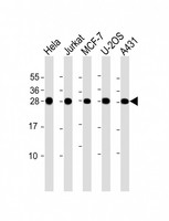 RPL14 / Ribosomal Protein L14 Antibody - All lanes: Anti-RPL14 Antibody (C-Term) at 1:2000 dilution. Lane 1: HeLa whole cell lysate. Lane 2: Jurkat whole cell lysate. Lane 3: MCF-7 whole cell lysate. Lane 4: U-2OS whole cell lysate. Lane 5: A431 whole cell lysate Lysates/proteins at 20 ug per lane. Secondary Goat Anti-Rabbit IgG, (H+L), Peroxidase conjugated at 1:10000 dilution. Predicted band size: 23 kDa. Blocking/Dilution buffer: 5% NFDM/TBST.